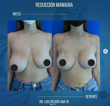 Slider image (4) Dr. Luis A. Picard Ami Jr, FACS, FRCSC